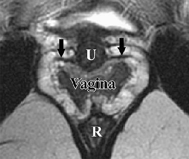 2007 07 20 14 46 16 706