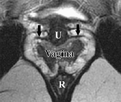 2007 07 20 14 46 16 706