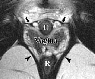 2007 07 20 14 46 30 706