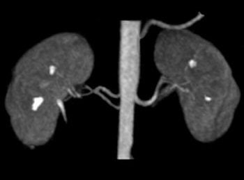 2007 07 25 14 42 00 706