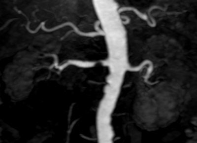 2007 07 25 14 42 25 706