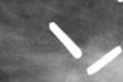2007 07 26 11 56 35 706