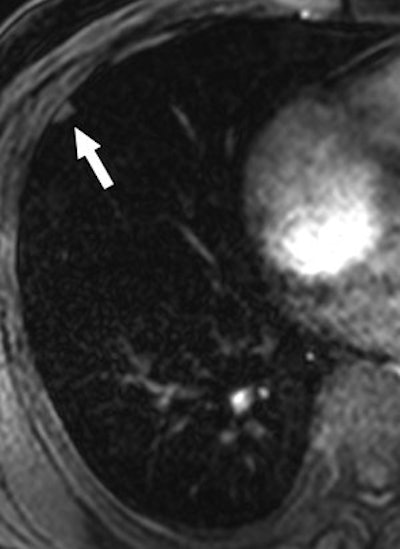 2007 07 27 14 07 16 706