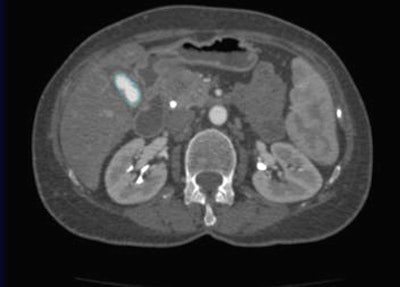 2007 08 15 12 26 49 706