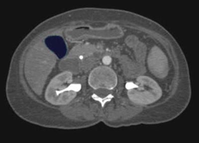 2007 08 15 12 27 08 706