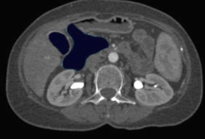 2007 08 15 12 27 26 706