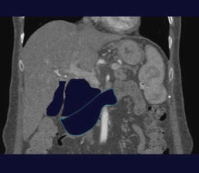 2007 08 15 12 27 56 706