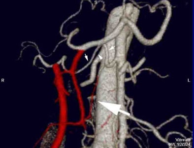 2007 08 15 12 28 26 706