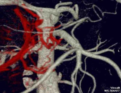 2007 08 15 12 29 35 706