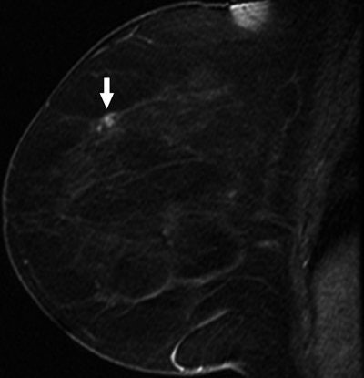 2007 08 15 13 06 42 706