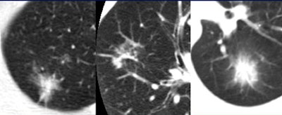 2007 08 21 14 44 01 706