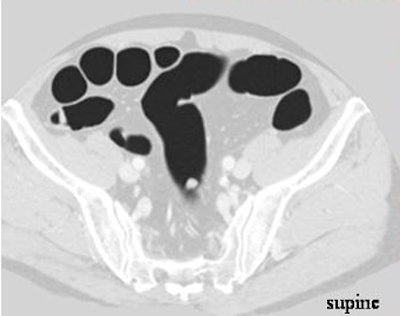 2007 08 27 14 08 32 706