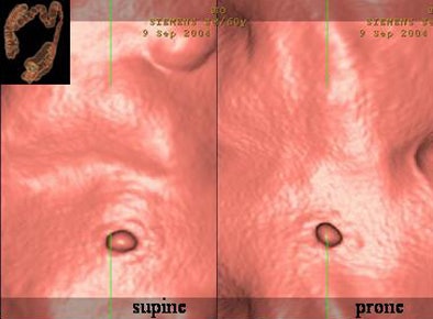 2007 08 27 14 08 57 706