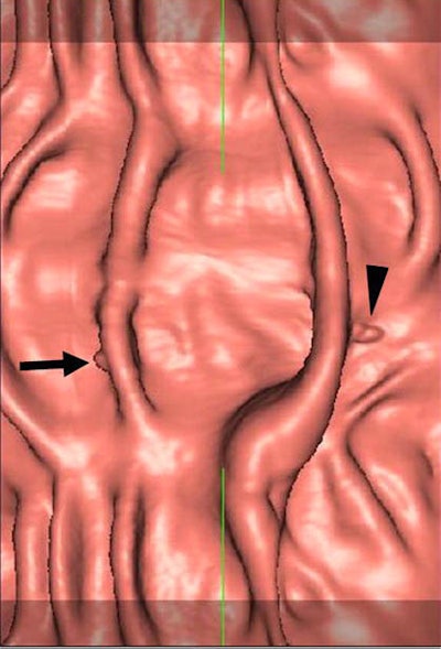 2007 08 27 16 00 41 706