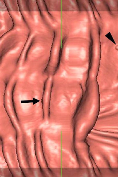 2007 08 27 16 01 13 706