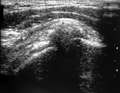 2007 08 31 14 54 33 706