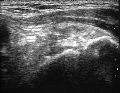 2007 08 31 14 54 47 706