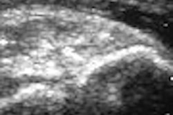 2007 08 31 14 54 58 706