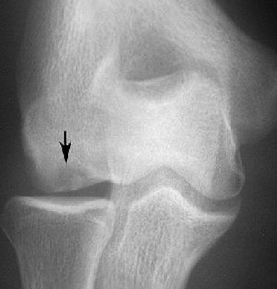 2007 08 31 15 39 24 706