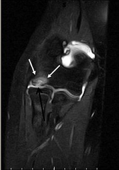 2007 09 03 15 13 13 706