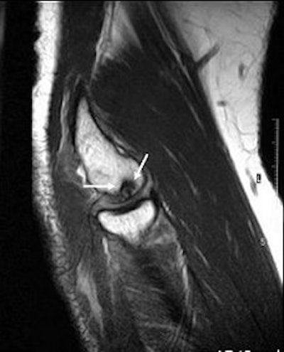 2007 09 03 15 13 58 706