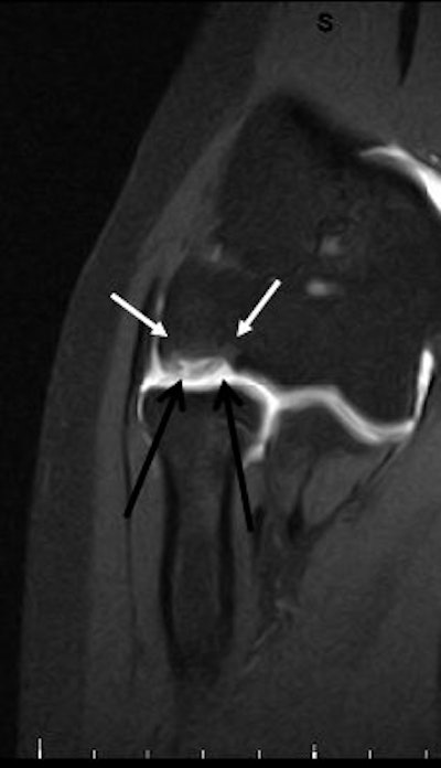 2007 09 03 15 14 37 706