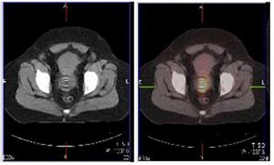 2007 09 10 11 42 49 706