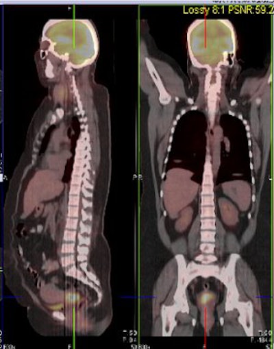 2007 09 10 11 43 07 706