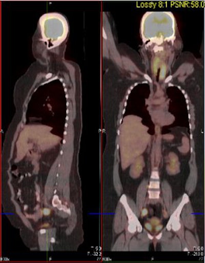 2007 09 10 11 43 38 706