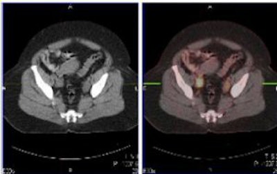 2007 09 10 11 50 58 706