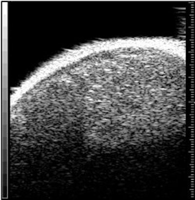 2007 09 13 09 20 32 706