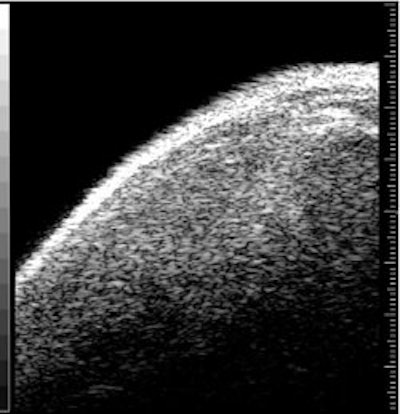 2007 09 13 09 23 54 706