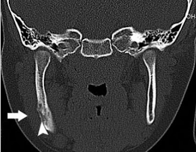 2007 10 02 16 05 40 706