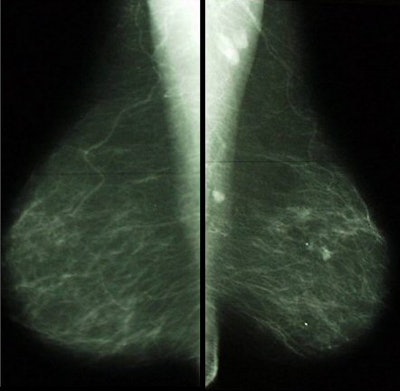 2007 10 09 15 23 44 706