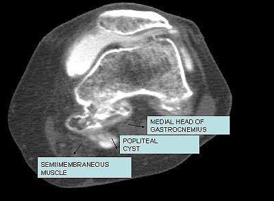 2007 10 17 14 17 38 706