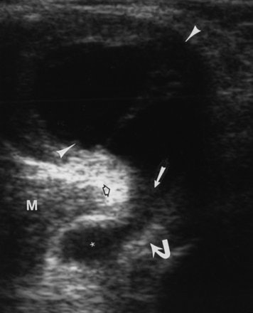 2007 10 17 14 18 05 706