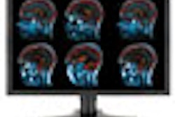 2007 11 01 13 17 18 706