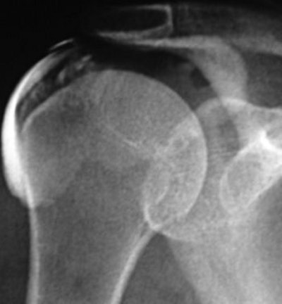 2007 11 05 11 22 08 706