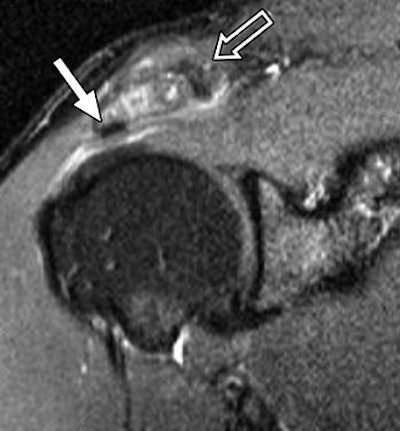 2007 11 05 11 22 20 706