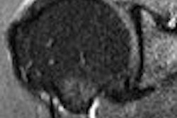 2007 11 05 11 22 32 706