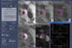 2007 11 05 15 42 14 706