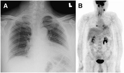 2007 11 14 15 34 33 706