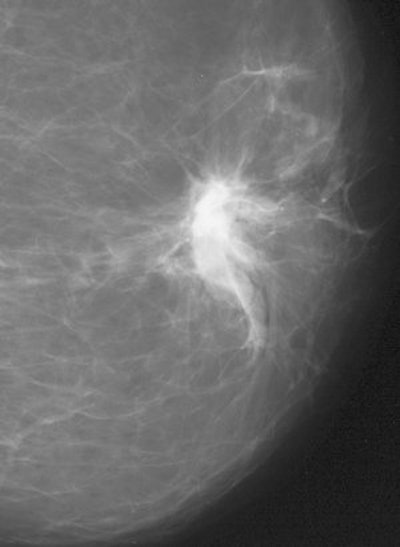 2007 11 16 08 49 25 706