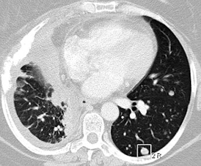 2007 11 16 08 58 44 706