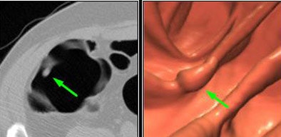 2007 11 16 16 29 38 706