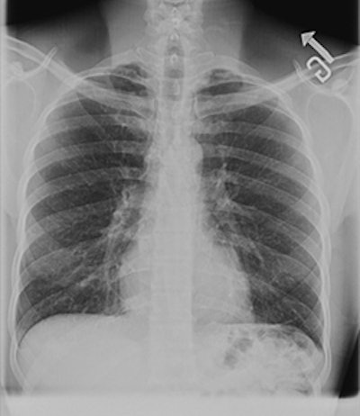 2007 11 26 11 29 21 706