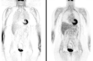 Attenuation Corrected