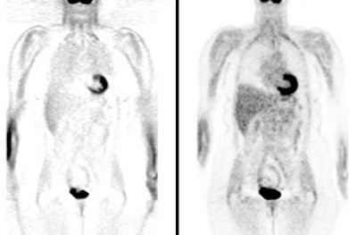 Attenuation Corrected