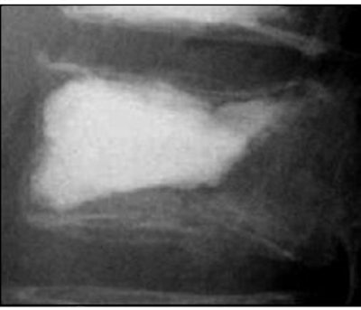 2007 12 04 15 41 39 706