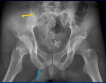 2007 12 12 16 21 22 706